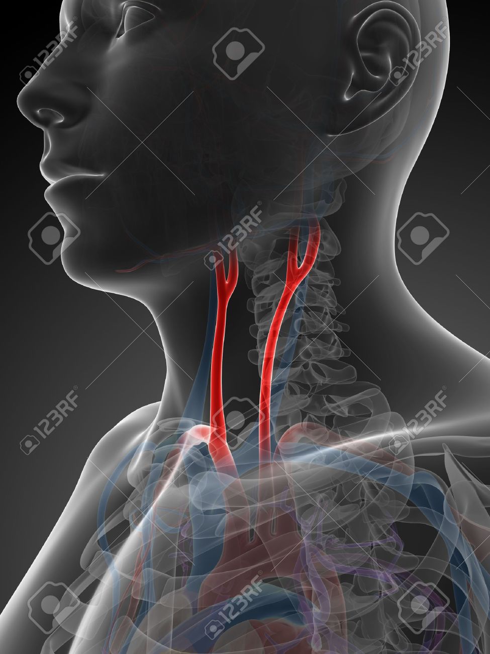 18448829-3d-rendered-illustration-of-the-carotid-artery-Stock-Photo[1]