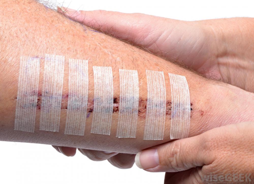 wound-covered-with-tape-near-hands